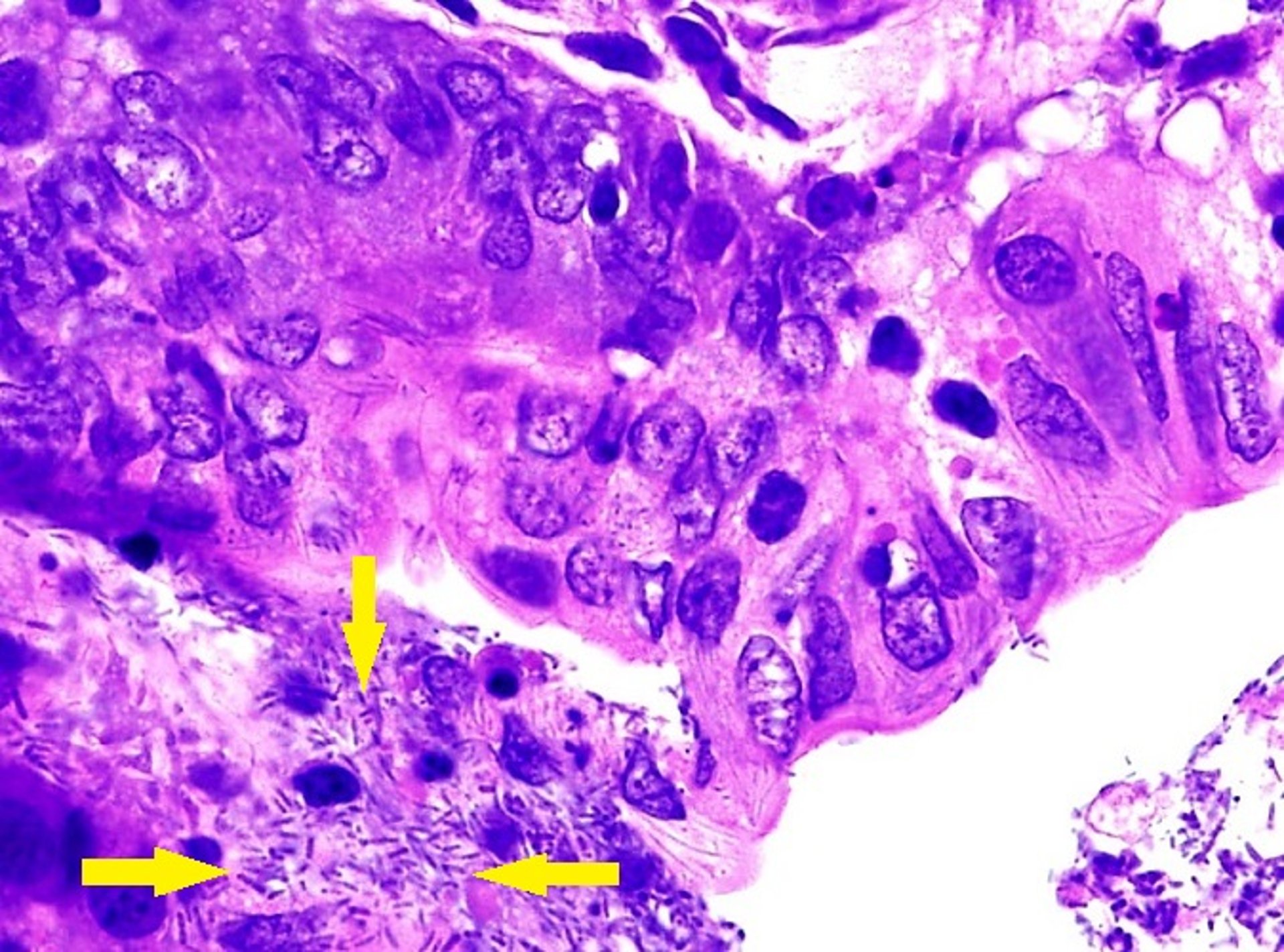 Tyzzer disease, colitis, rabbit, photomicrograph