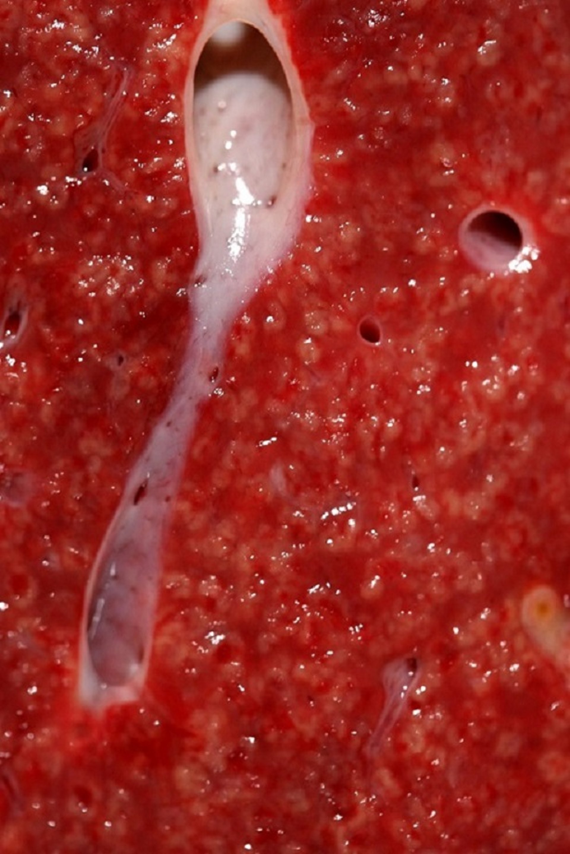 Tyzzer disease, hepatic necrosis, foal, gross specimen
