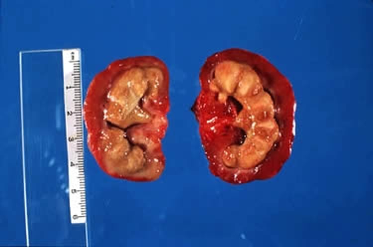 Renal calculus, Samoyed