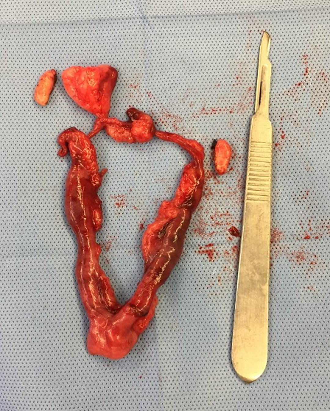 Uterine fat deposits, rabbit