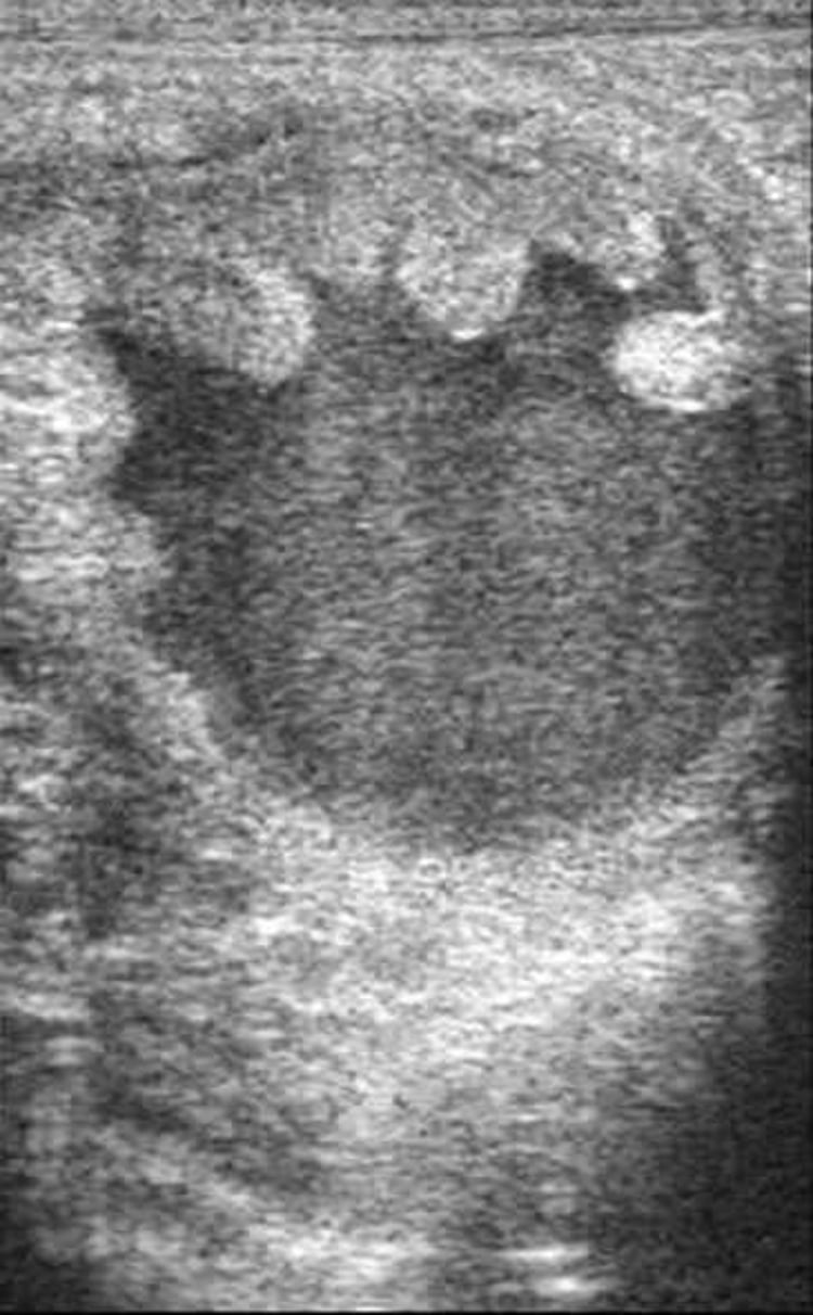 Sonogram of uterine fluid, mare