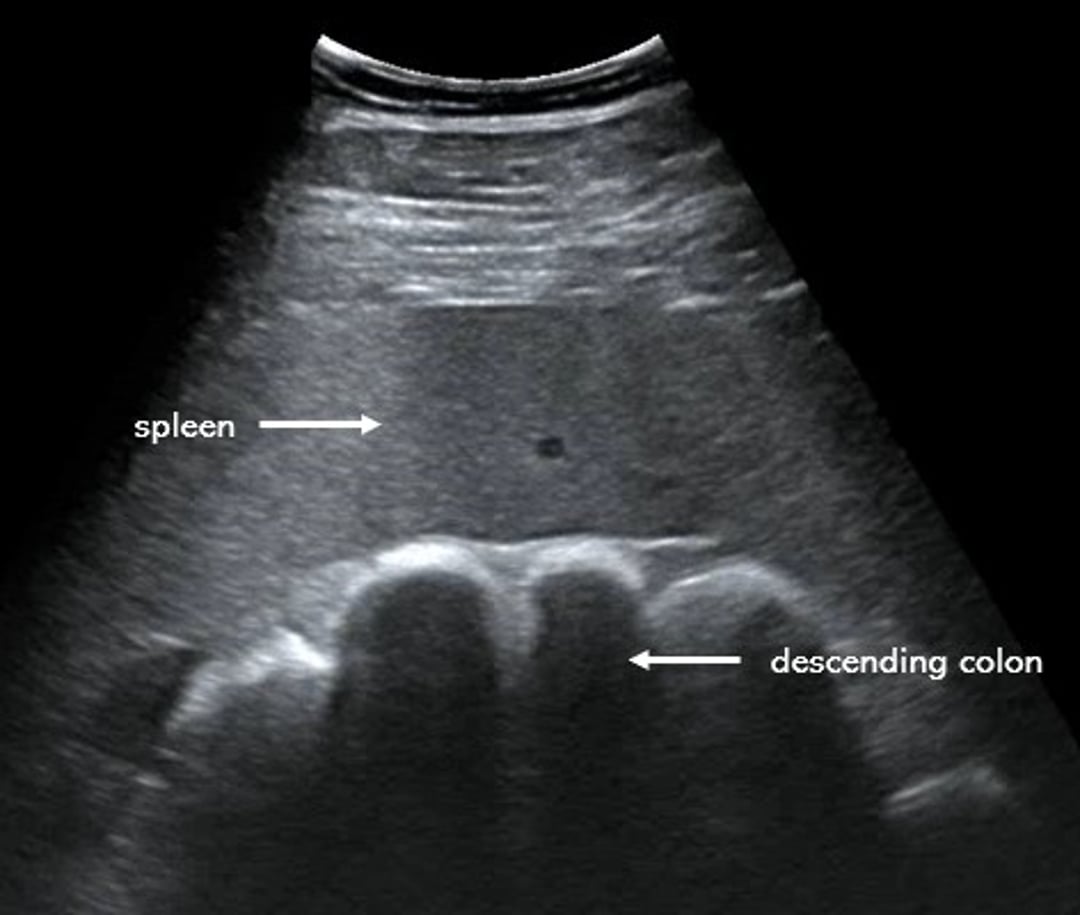 Ultrasonogram, descending colon and spleen, horse