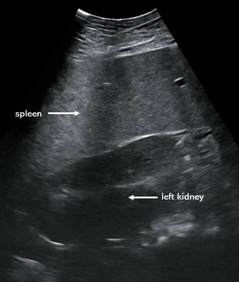 Ultrasonogram, left kidney and spleen, horse