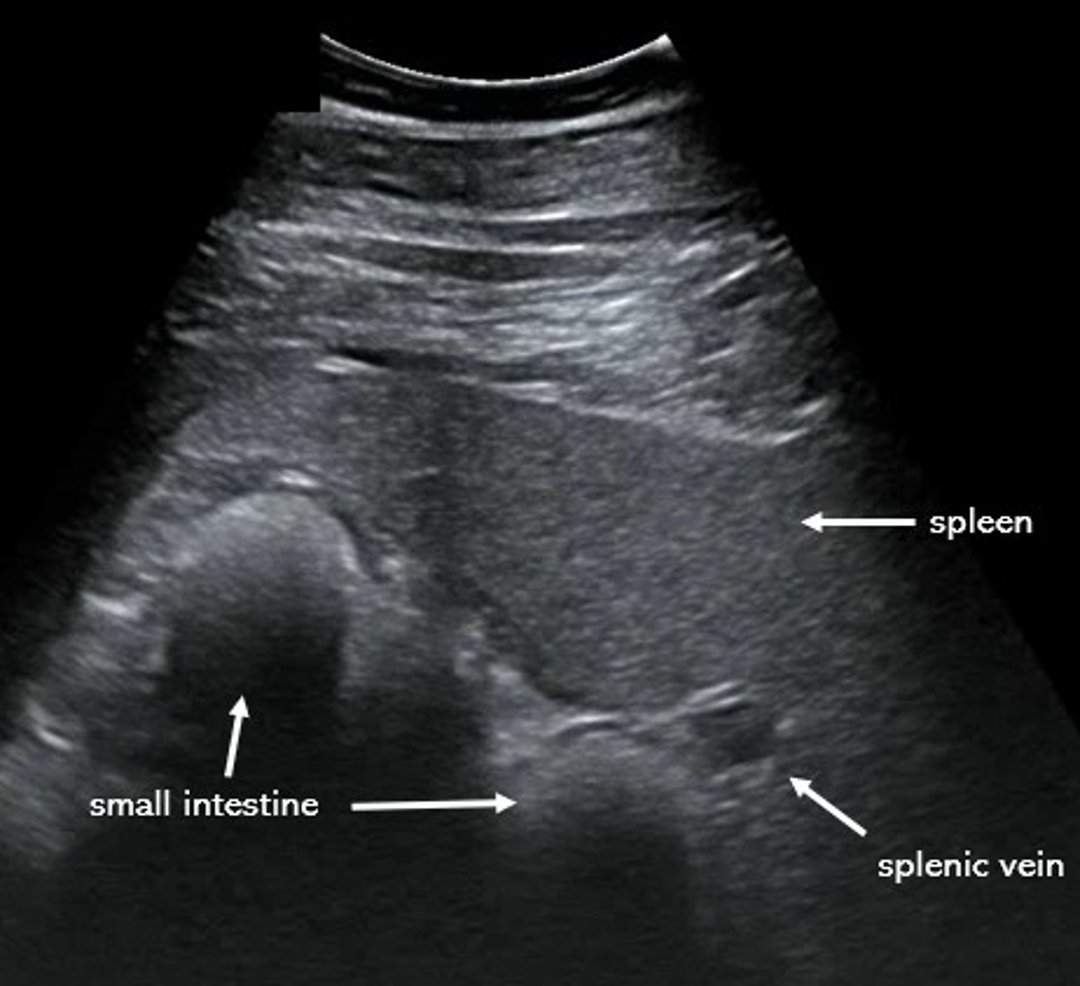 Ultrasonogram, small intestine and spleen, horse