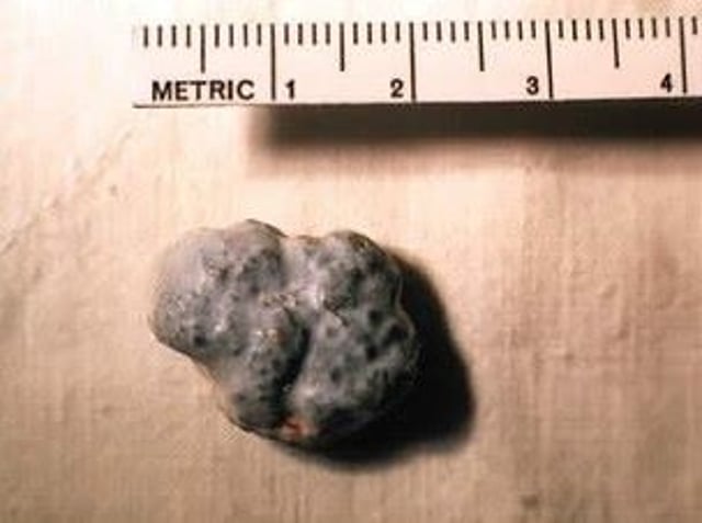 Urate bladder stone, Dalmatian