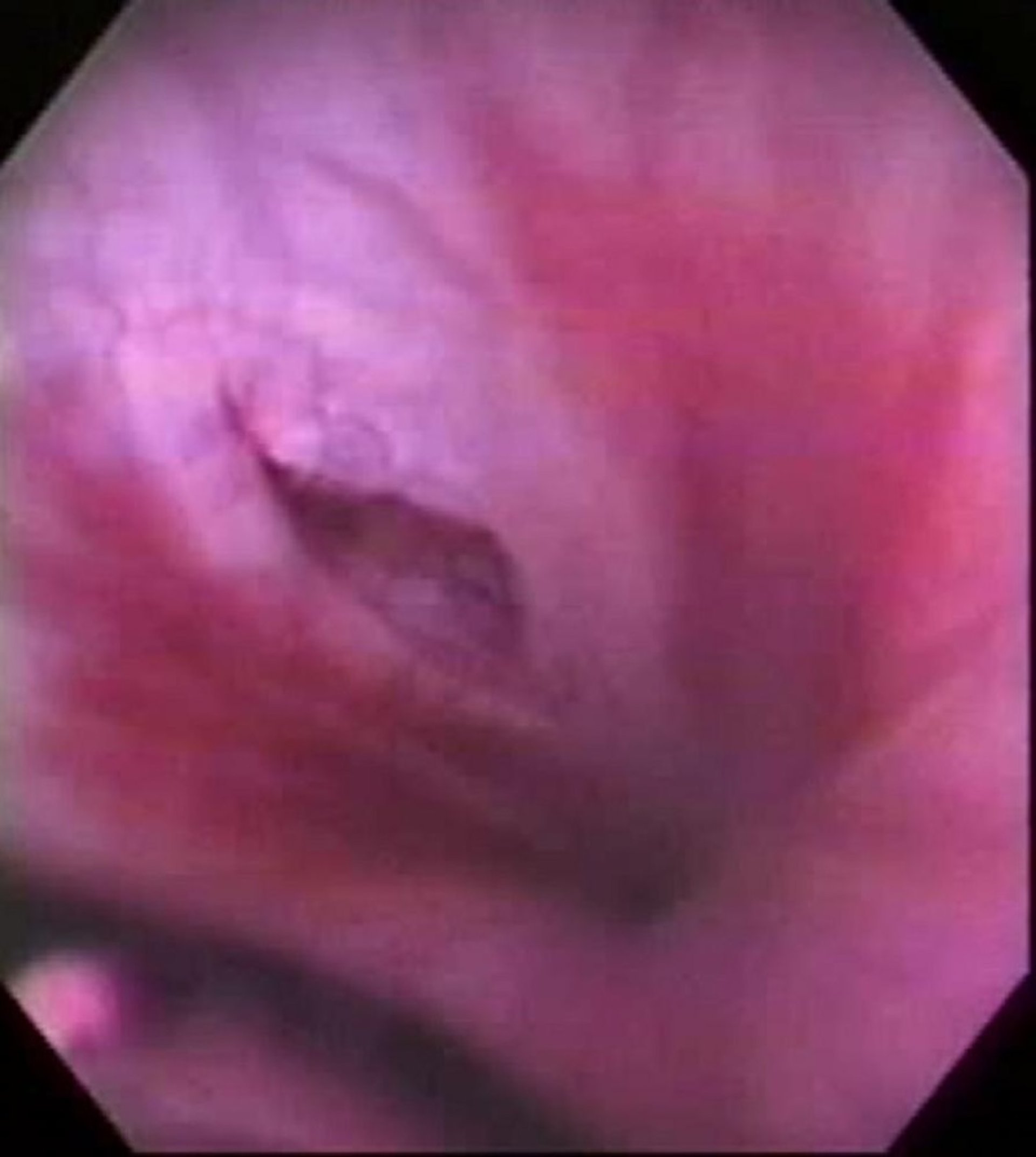 Urethral defect, endoscopic image, horse