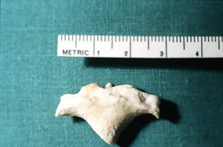Cálculo renal, Collie