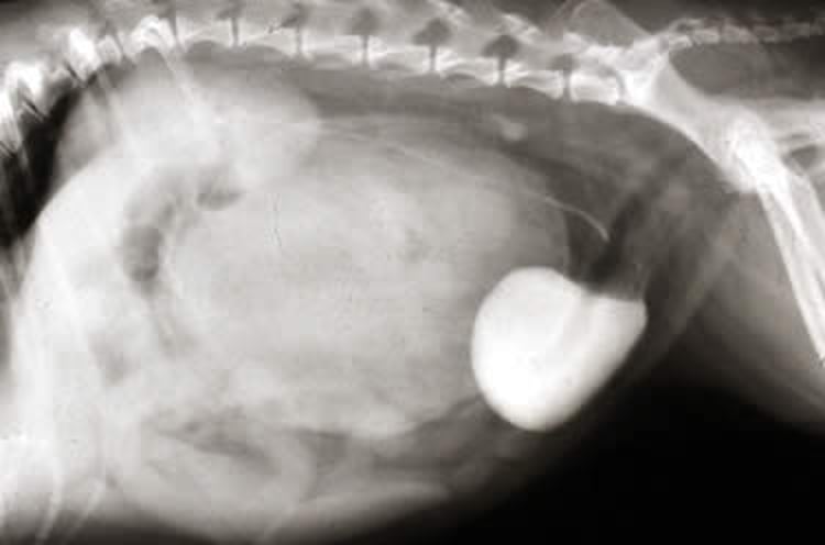 Hidronefrosis, pielograma, proyección lateral