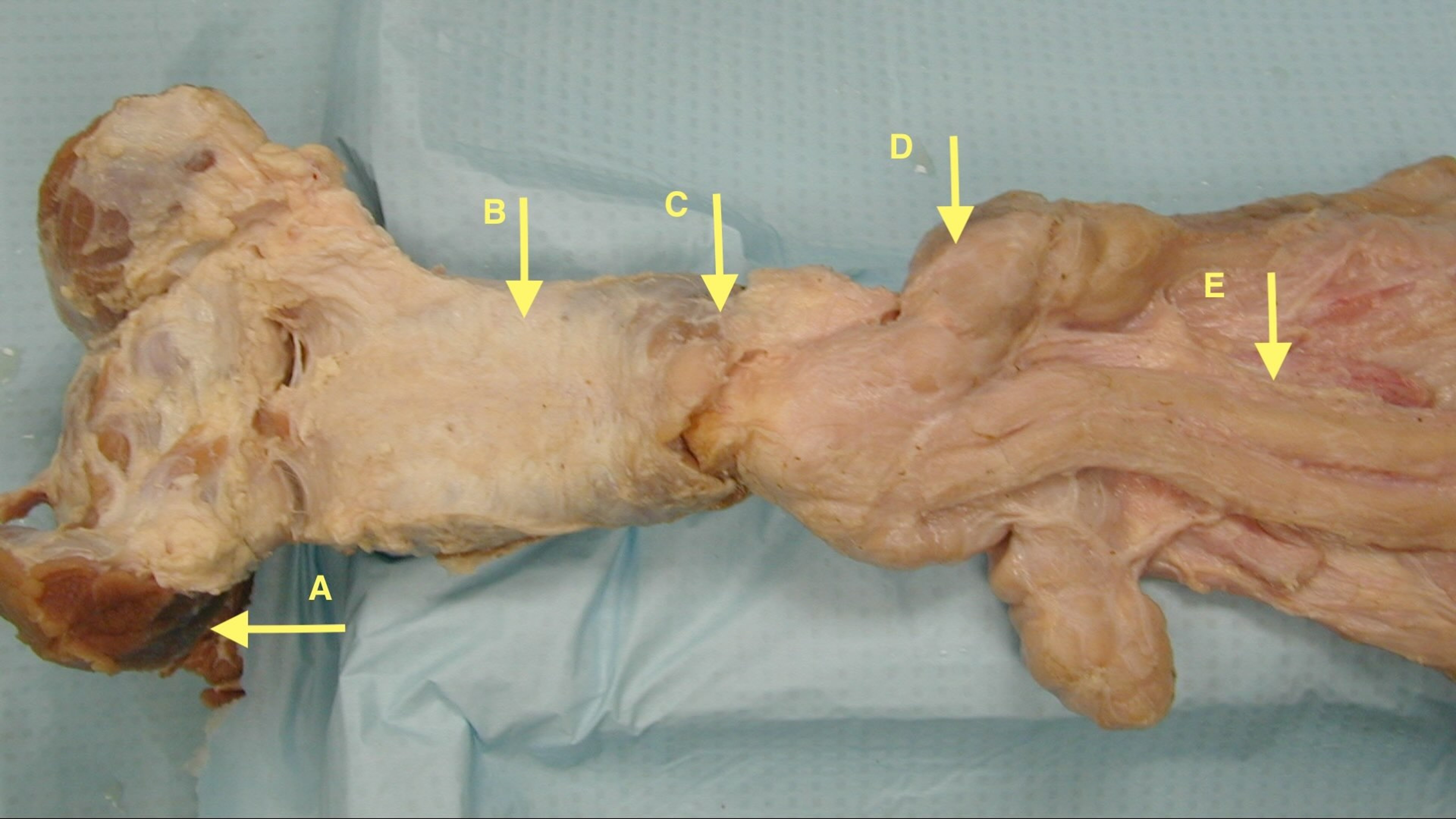 Trato urogenital, touro