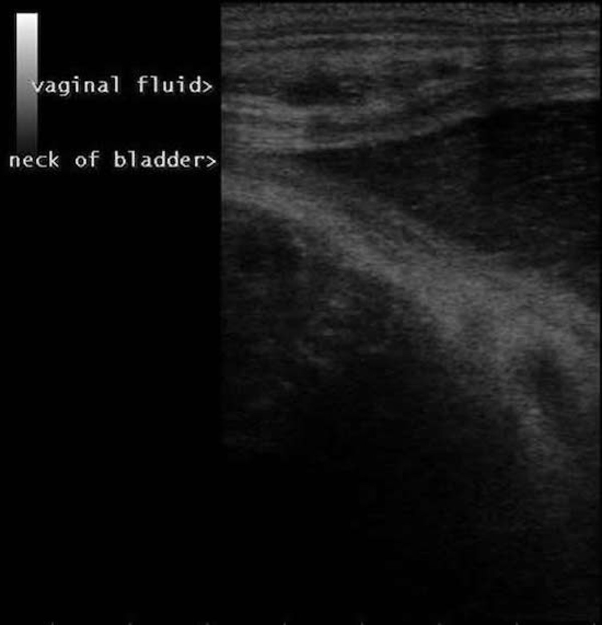 Sonogram of vaginal fluid, mare