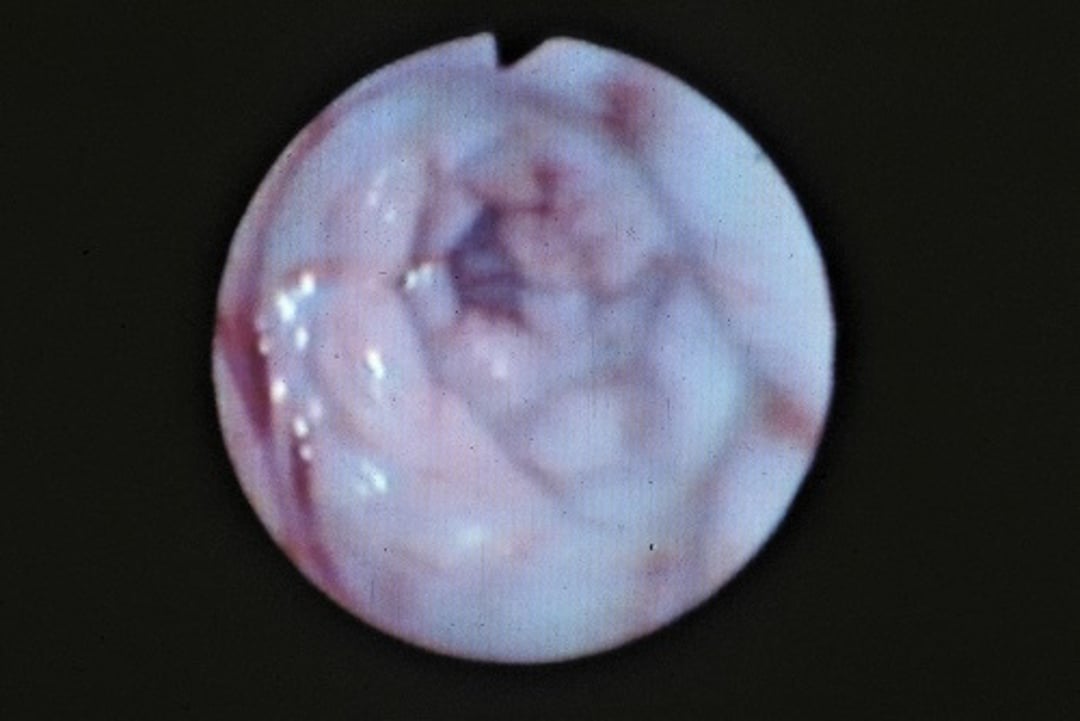Vaginoscopy during proestrus, dog