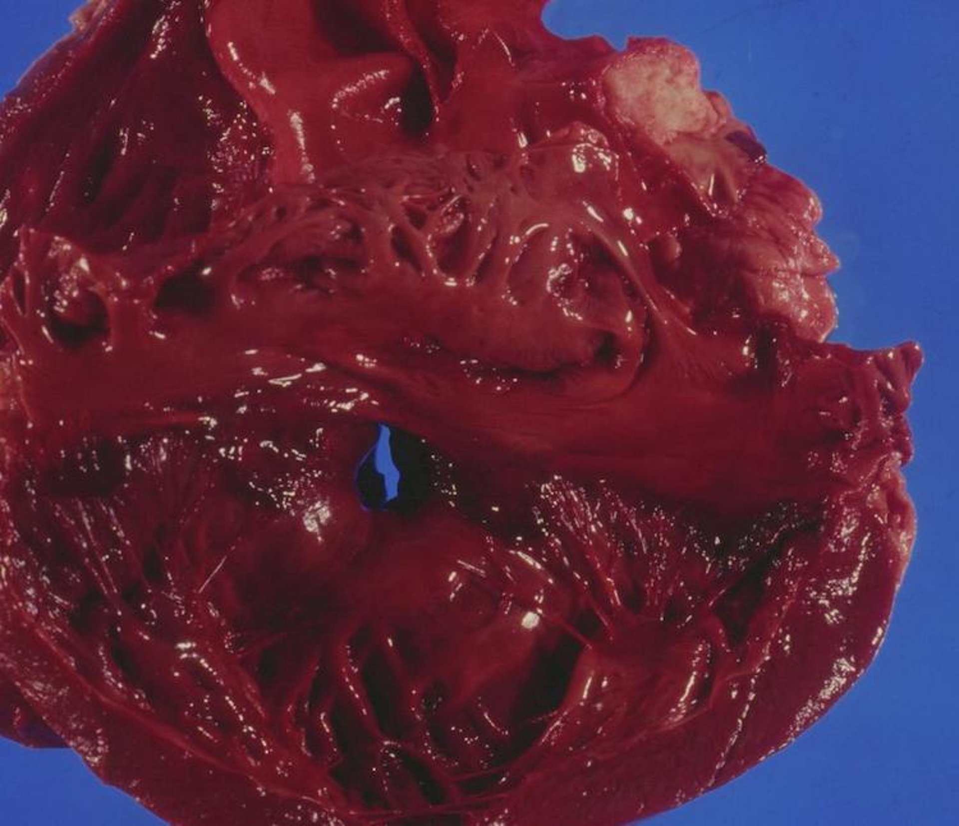 Ventricular septal defect, llama