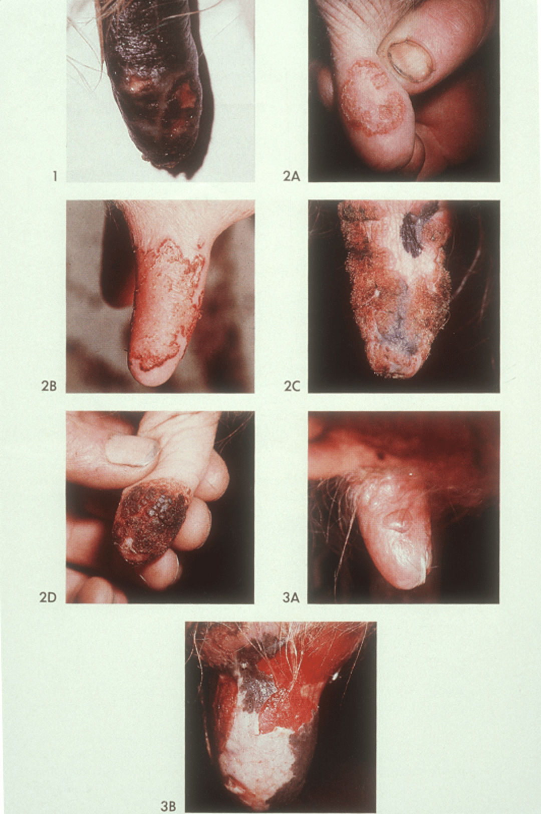 Viral skin infections of the teat, cow