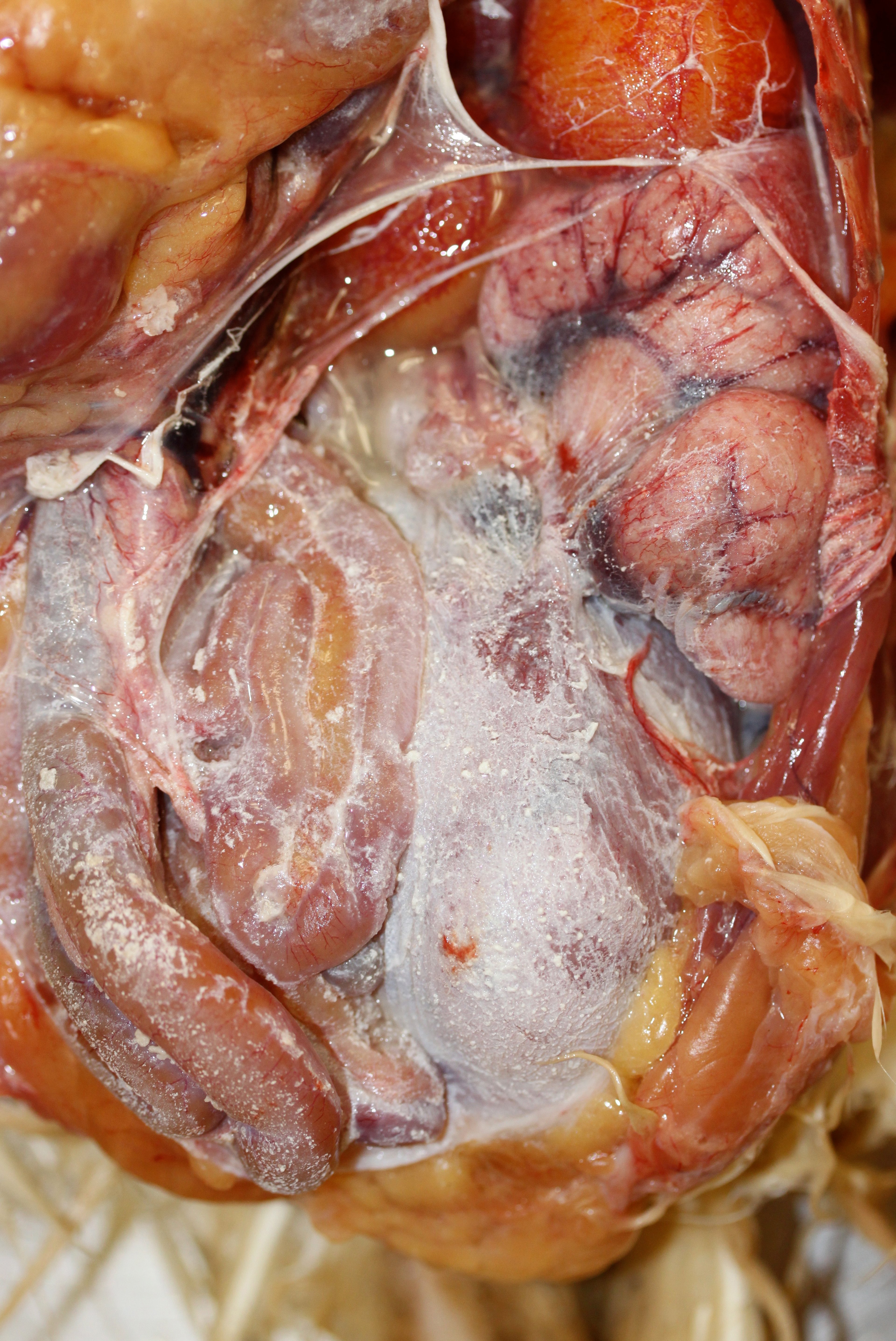 Visceral urate deposition