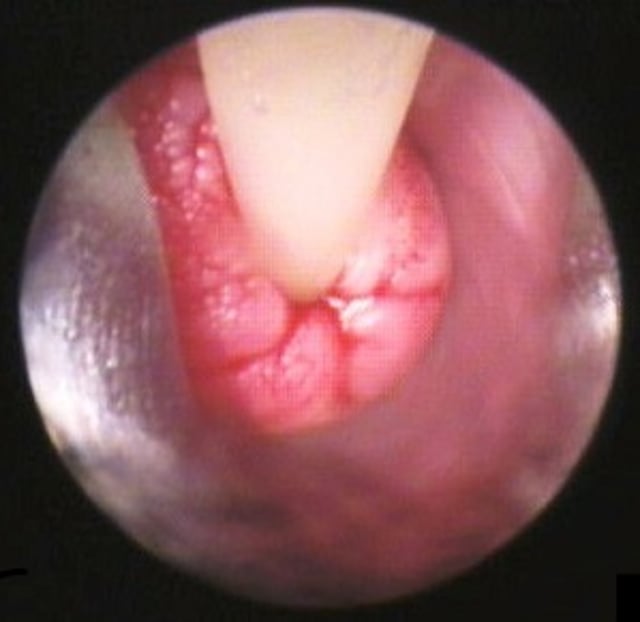 Vaginoscopy for transcervical insemination, bitch