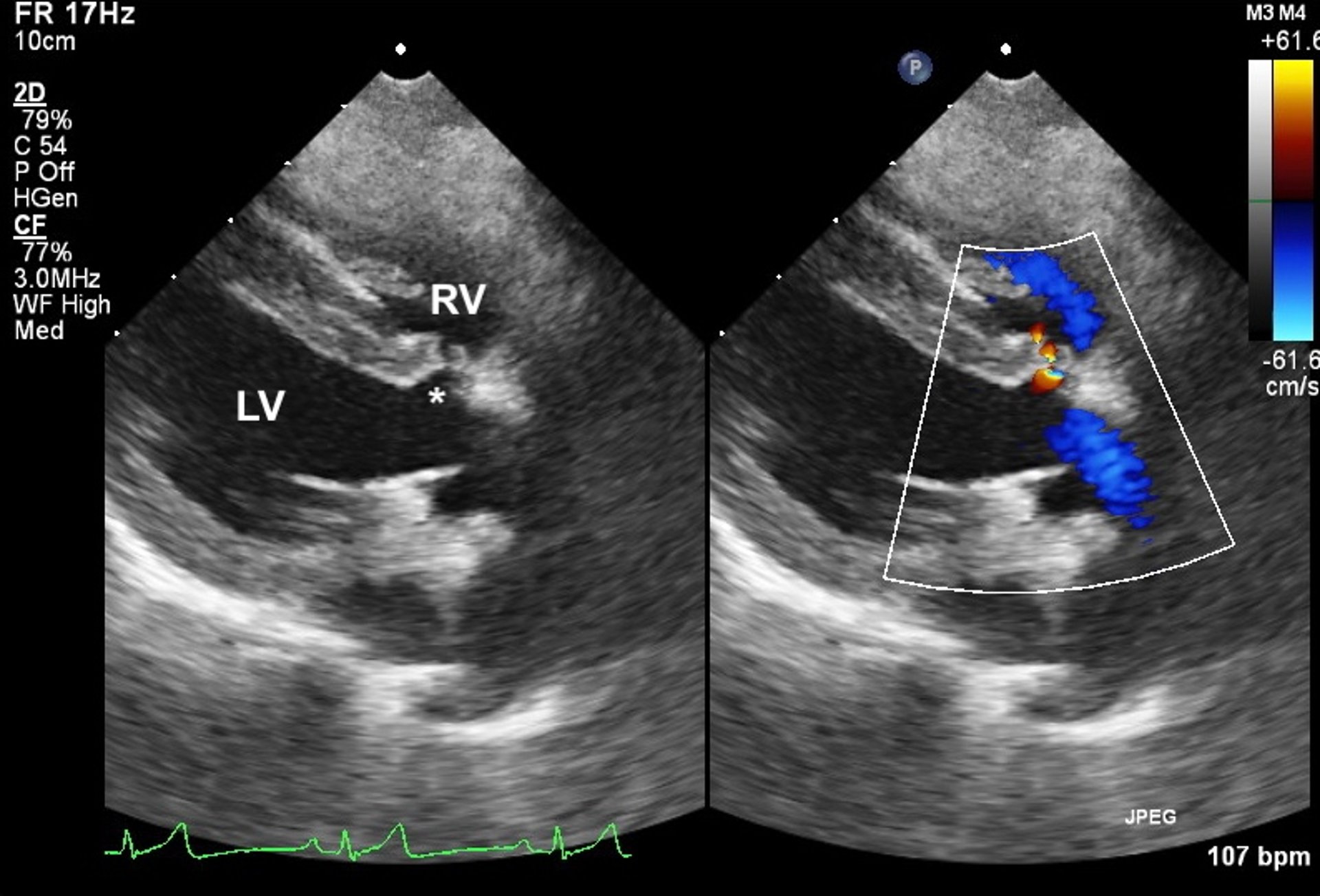 Comunicación interventricular, ecocardiografía, perro