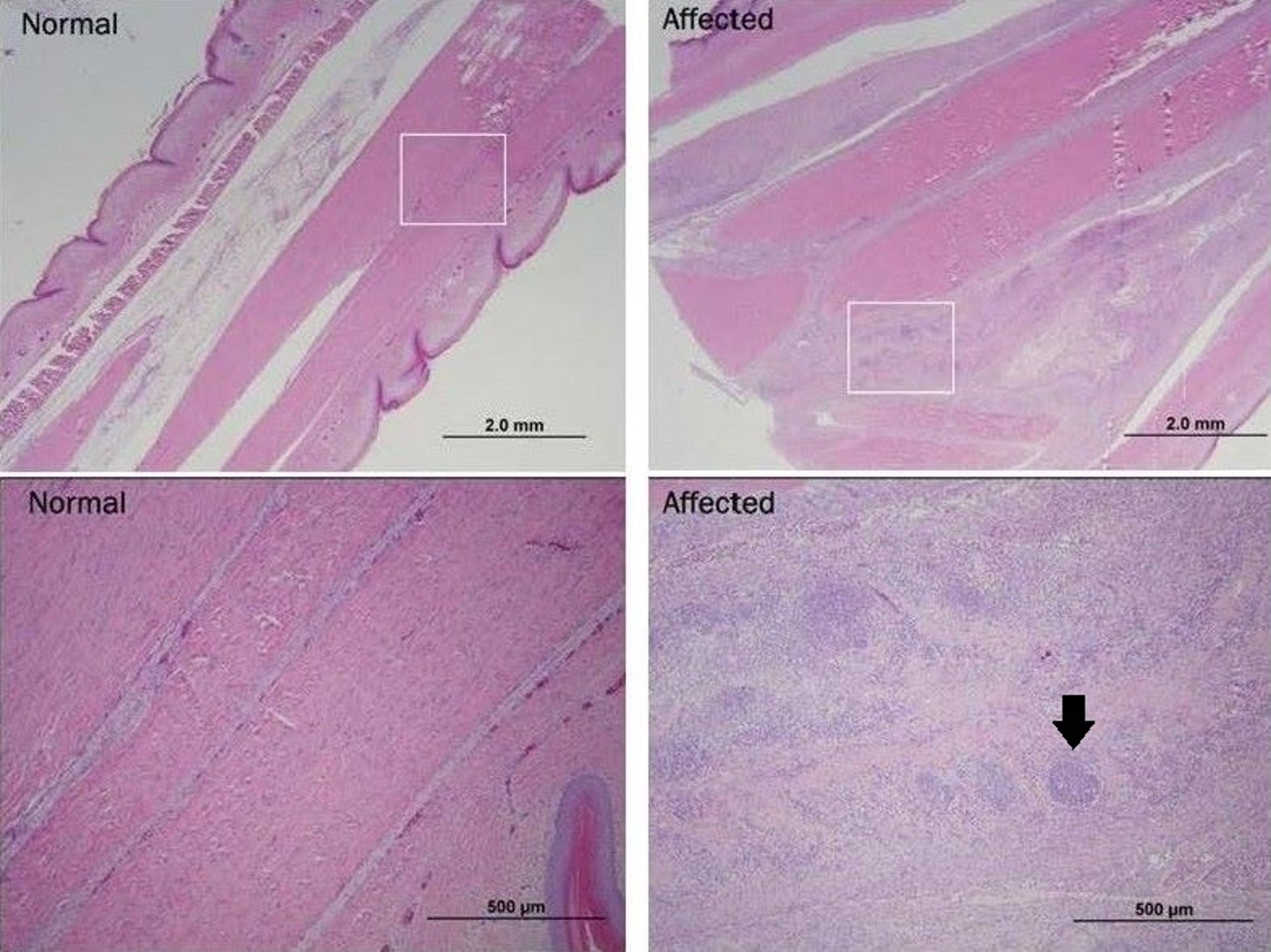 Viral arthritis, tendons, histological images, poultry