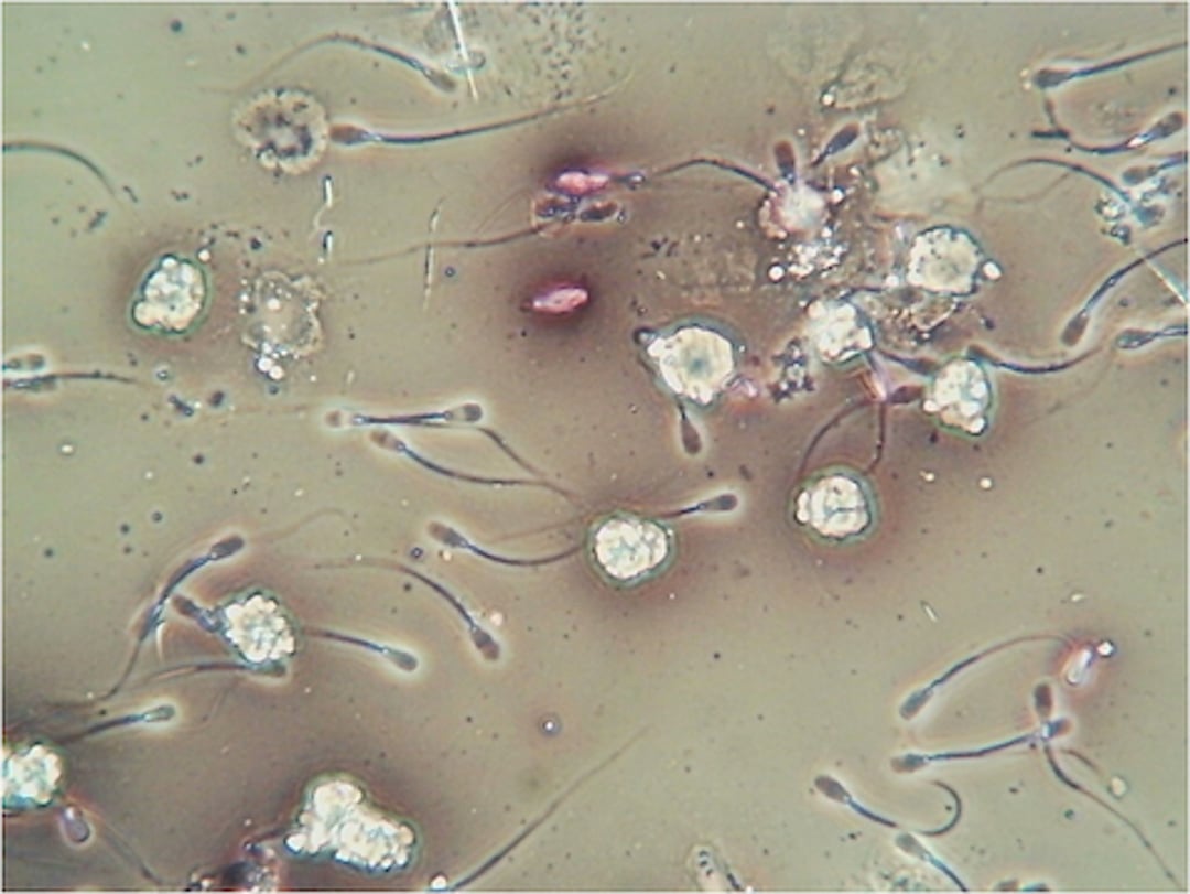 Leucocitos, tinción de eosina-nigrosina, toro