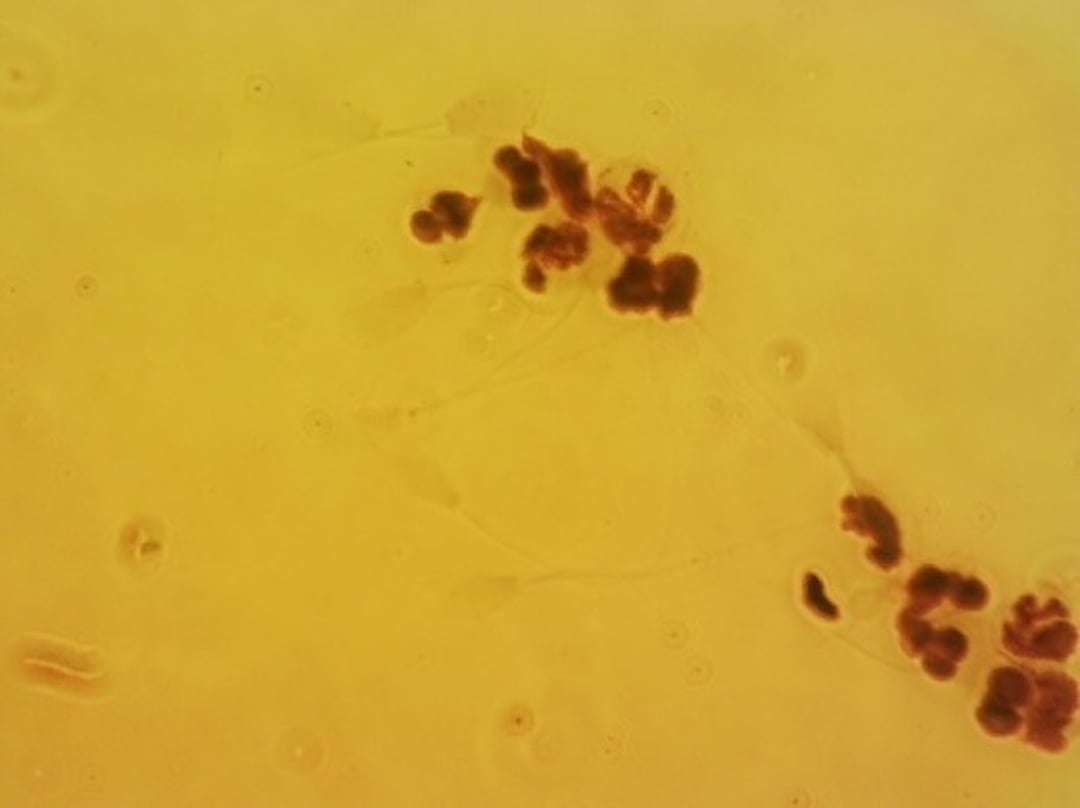White blood cells, modified Giemsa stain, bull