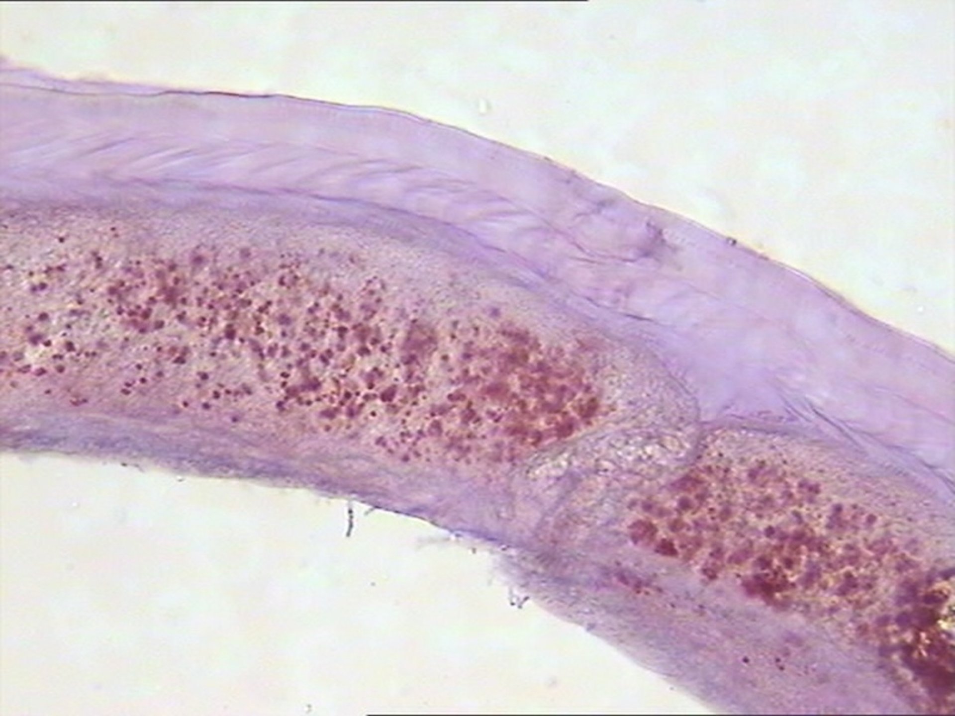 <i >Wolbachia pipientis</i> in <i >Dirofilaria immitis</i>, photomicrograph