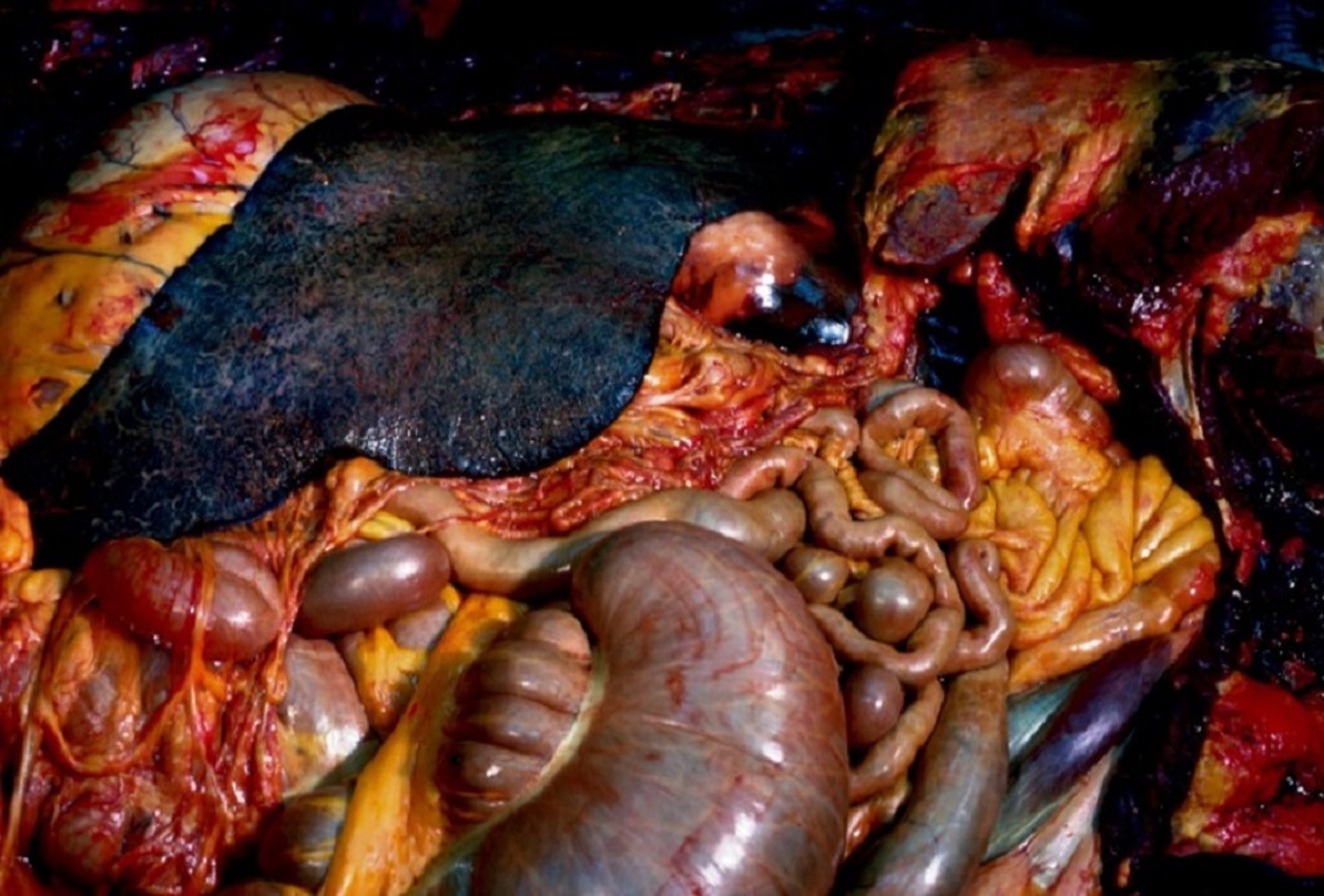 Yellow discoloration due to icterus, horse