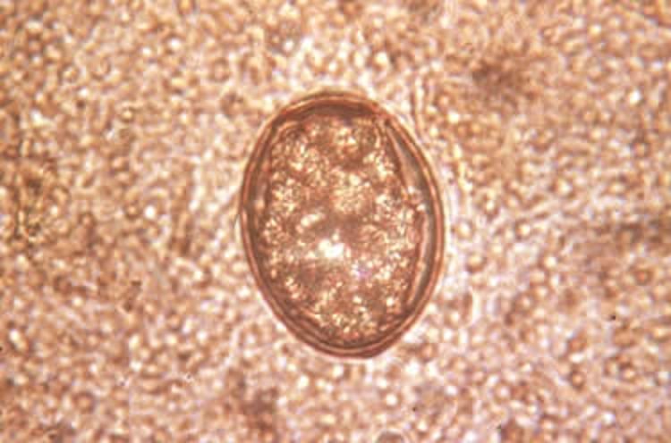 <i >Zalophotrema hepaticum</i> ovum