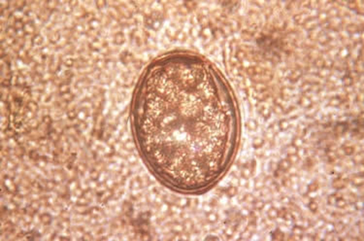 <i >Zalophotrema hepaticum</i>, huevo embrionado