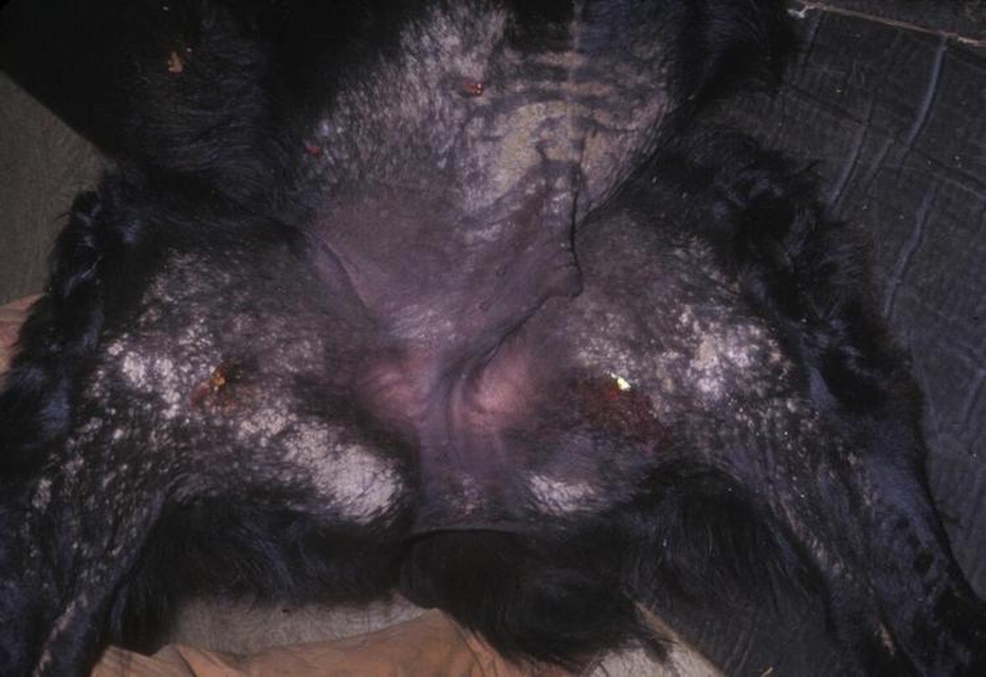 Dermatosis que responde al zinc, llama