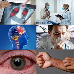 Conheça alguns dos principais danos para a saúde e para a vida | Saiba mais | Nederman