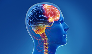 Além do sistema respiratório a poeira metálica pode intoxicar órgãos como rins, fígado, provocar doenças e inflamações nos olhos e enfermidades neurológicas. | Nederman