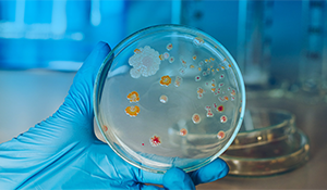 A qualidade do ar controlada reduz significativamente os riscos de contaminação microbiológica, protegendo a saúde do consumidor e preservando a integridade do produto final. | Saiba mais | Nederman