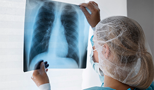 Risco a saúde por inalação de partículas sólidas e outros poluentes suspenso no ar no ambiente industrial 