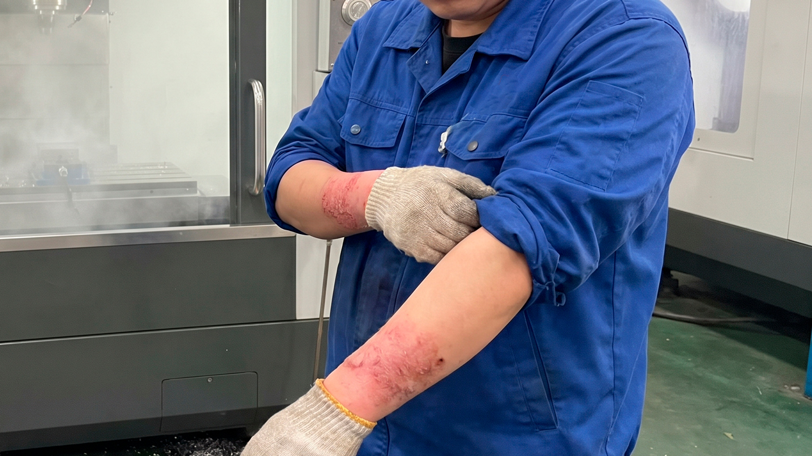 O contato dérmico com a névoa depositada causa dermatites de contato e outras reações alérgicas que elevam o absenteísmo na produção. | Saiba mais | Nerderman