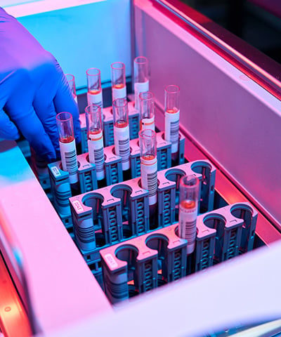 A container full of medical vials.