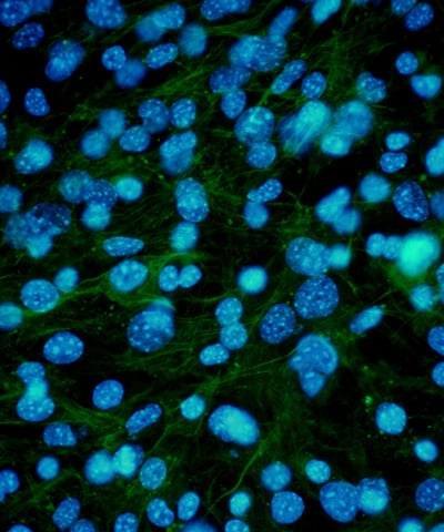 Zoomed-in imagery of cells and microbes.