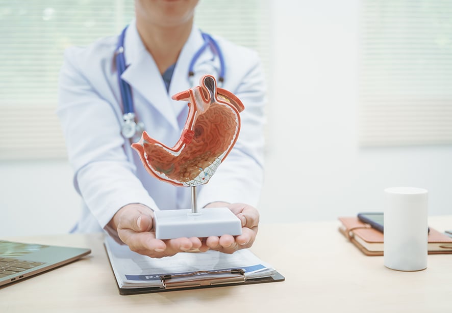 A doctor showing a model of the stomach
