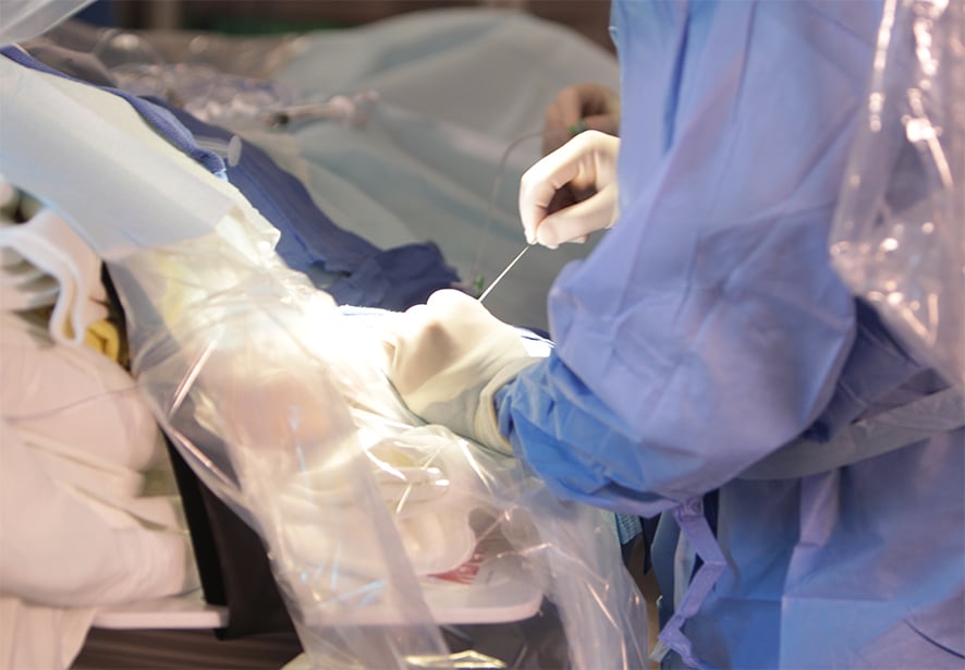 A doctor preforming a catheter ablation