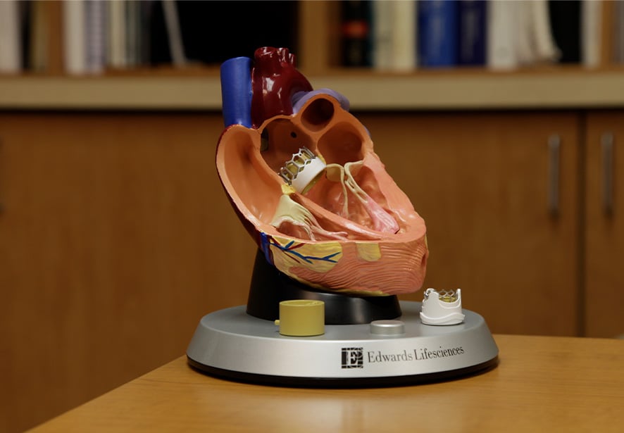 A model of the heart showing the TAVR device