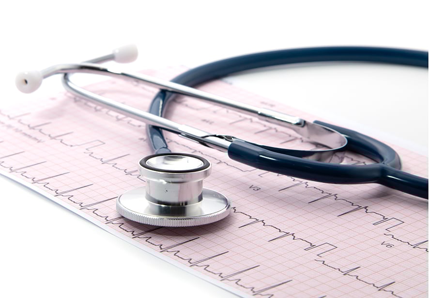 Blue Stethoscope on electrocardiogram 