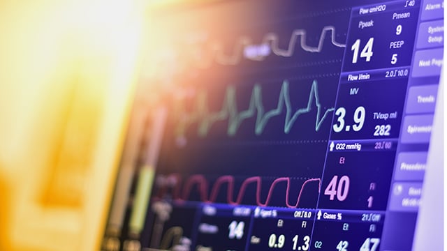 EKG monitor with a sun flare