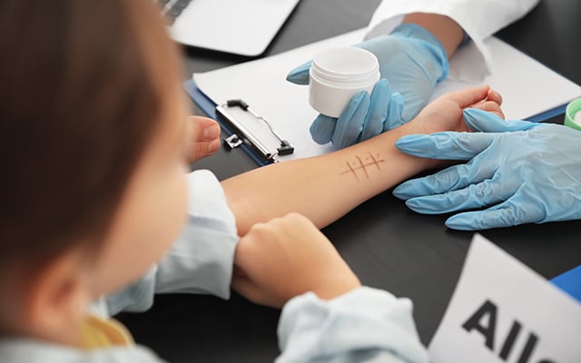 A child being prepped for a allergy skin test