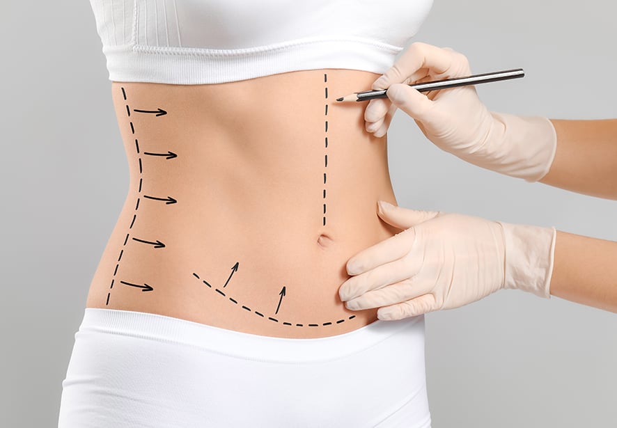 Cosmetic surgery procedures 