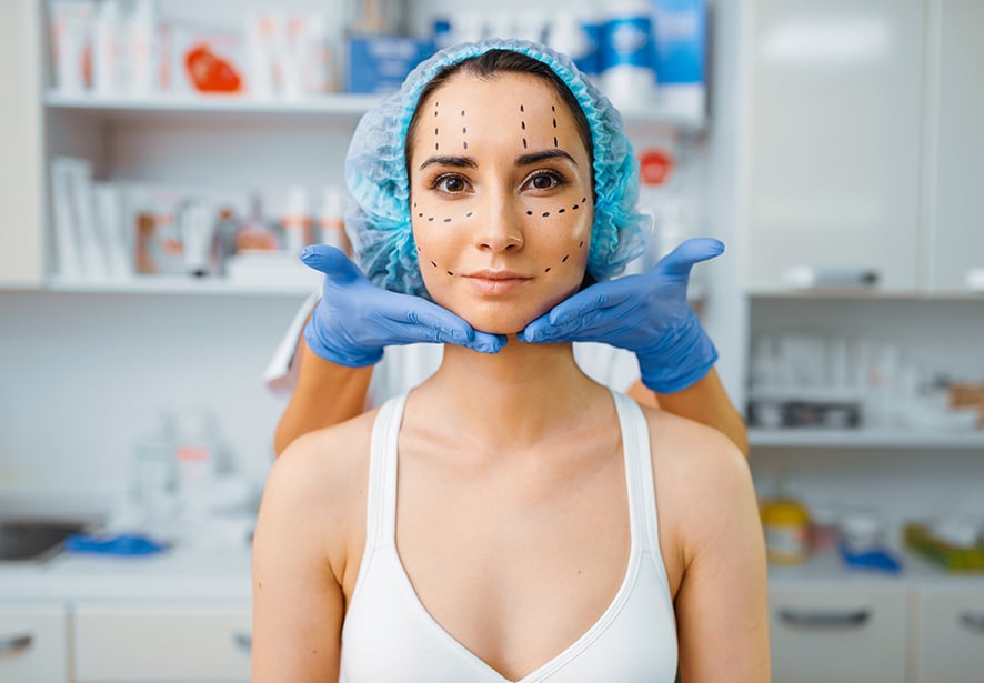 A patient with her line drawn for a face lift 