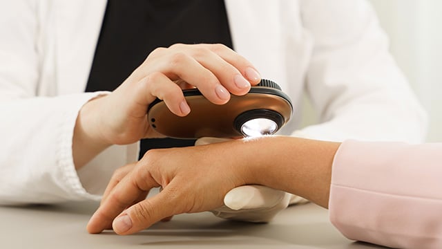 Dermatologist using dermatoscope for skin examination on a patients hand