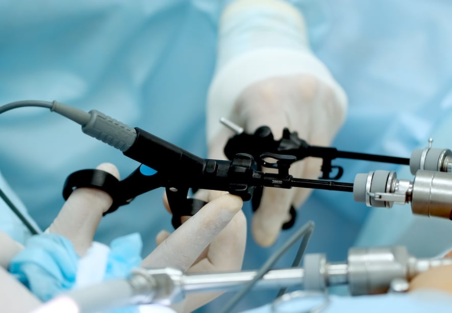 A close up view of a surgical team performing surgery with instruments 