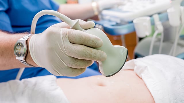 A health care provider holding an ultrasounds probe over a woman stomach
