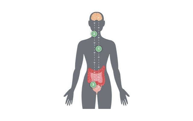 Axonics Therapy graphic of how it works within the body