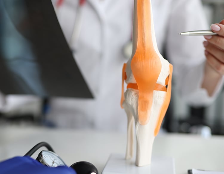 A up close view of the knee joint model with a doctor faded in the background holding an x-ray