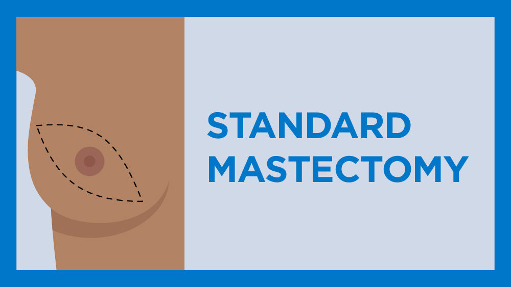 medical illustration depicting a standard mastectomy on brown skin