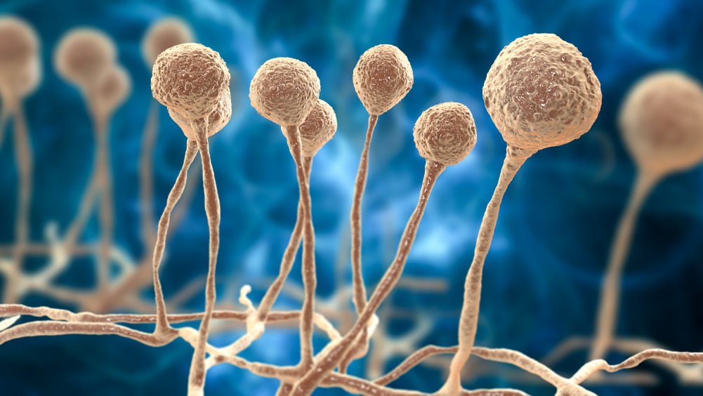 Medical illustration of fungal infection